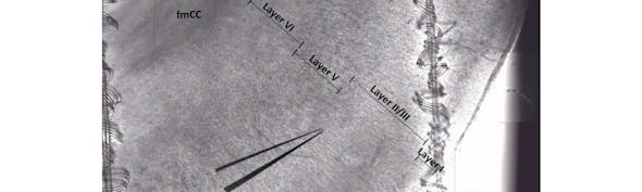 Micromanager Stitching